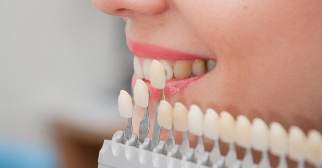 Choice of color of a dental artificial limb. The woman on reception at the dentist. Close-up