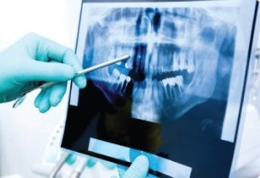 dental-imaging